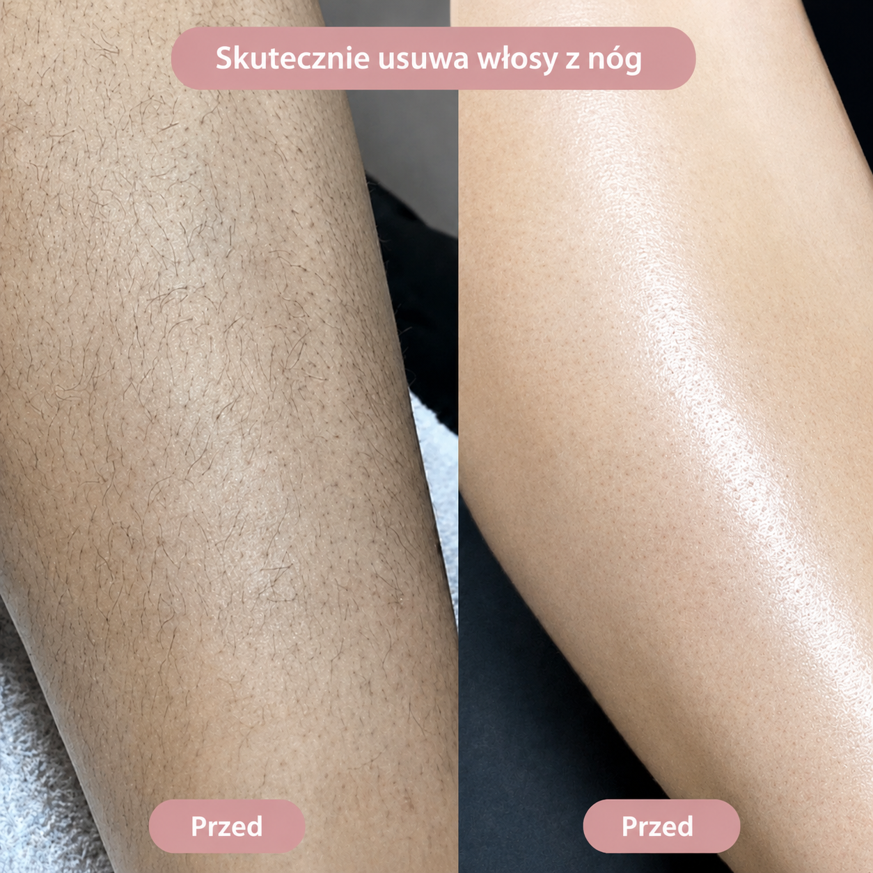 SilkySkin – Golenie okolic intymnych bez podrażnień